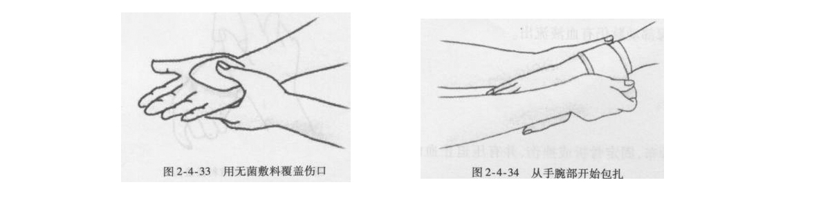 医用绷带8字包扎法.jpg